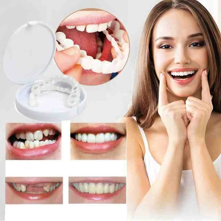 niki-instant-smile-cosmetic-veneers-dental-prothesis-f49bf130_9af752c0-b17a-4b20-8470-abe3a1cbe120