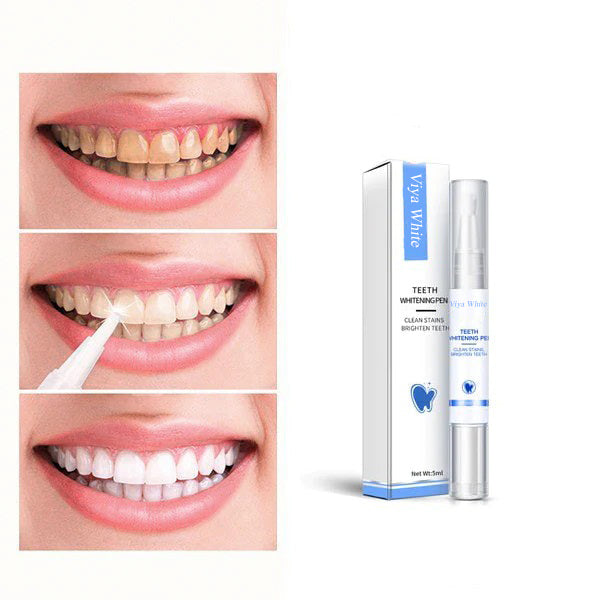 quick-teeth-whitening-for-a-radiant-smile-7b4f4dd8_b128e11e-8c0d-45d1-a975-389669602ca9